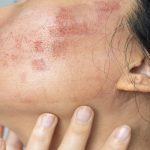 What Natural Skincare Remedies Are Scientifically Proven?