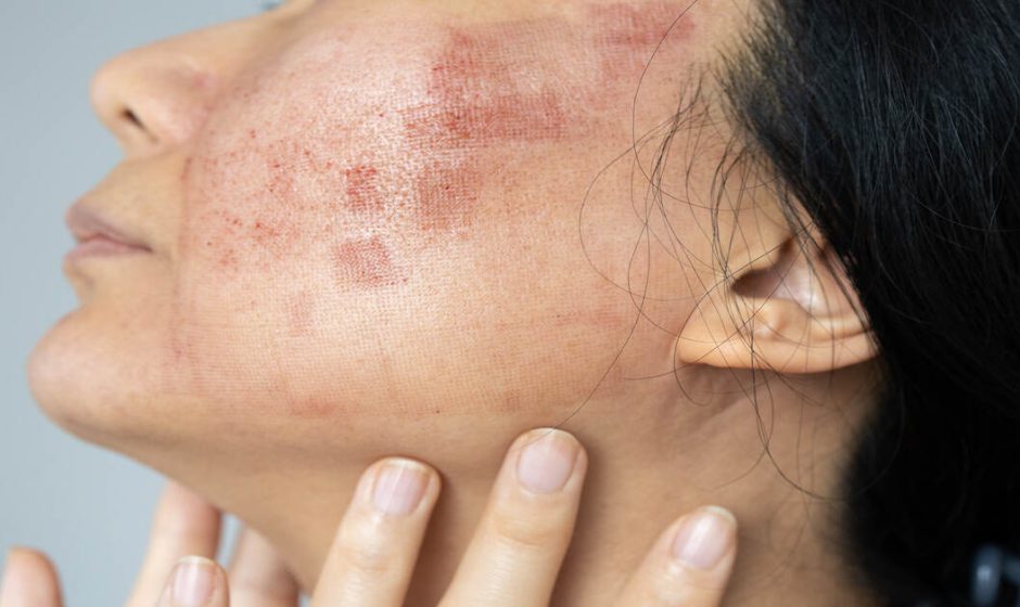 Understanding Skin Inflammation