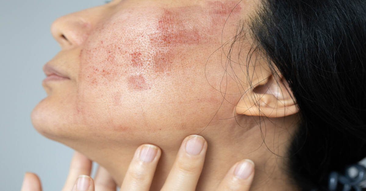 What Causes Skin Inflammation and How Can You Manage It?