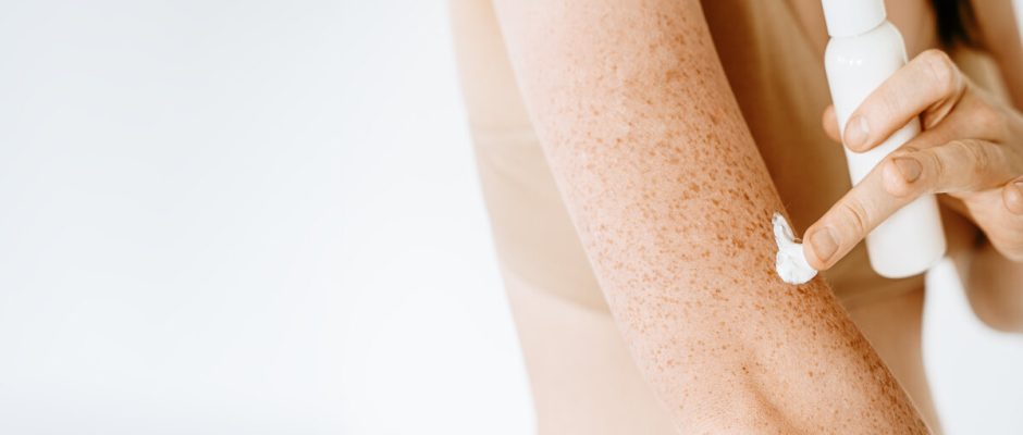 Understanding Psoriasis Skin Changes