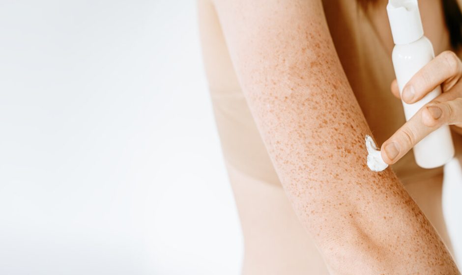 Understanding Psoriasis Skin Changes