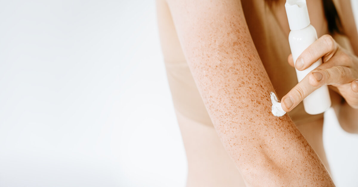 What Happens to Your Skin with Psoriasis?