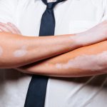 What Foods Contribute to Healthy Skin?