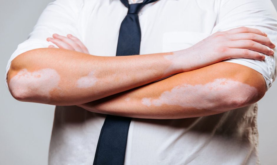 Recognizing Skin Conditions