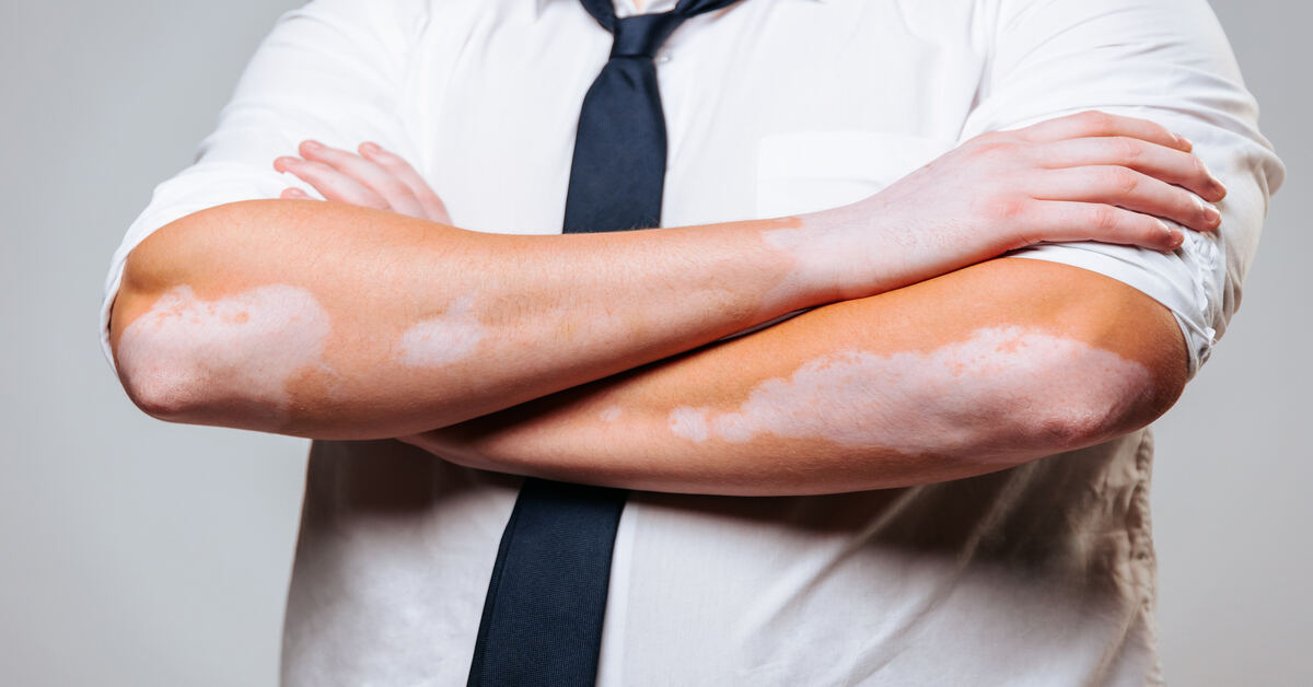 How Can You Recognize Skin Conditions and Know When to Seek Help?